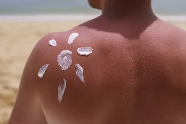 view man applying lotion sunburn skin beach